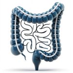 Colorectal Cancer Kindle Book English Medical Guide Patients-0