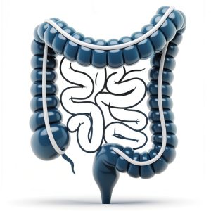 Colorectal Cancer Kindle Book English Medical Guide Patients-0